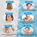 shower-filter-for-hard-water-with-carbon-filter-removes-chlorine-heavy-metals-and-chemicals-reduces-dry-skin-4-spray-modes-06-shower-filter-for-hard-water-with-carbon-filter----6.jpg